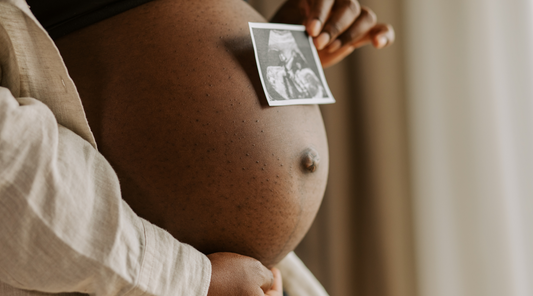 a pregnant holding an ultrasound photo on her baby bump